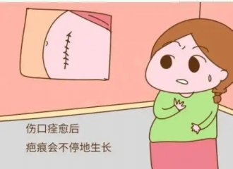 ϾƤô