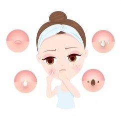 南京皮研所祛痘印怎么样