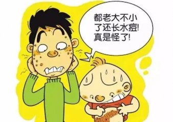 蛇盘疮是什么样子的